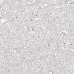 Invitrogen HOXA11 Polyclonal Antibody 100 &mu;L | Buy Online | Invitrogen&trade; | Fisher Scientific