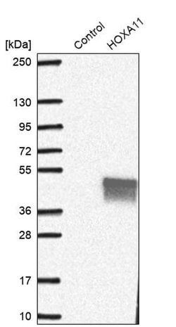 Invitrogen HOXA11 Polyclonal Antibody 100 &mu;L | Buy Online | Invitrogen&trade; | Fisher Scientific