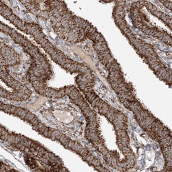 Invitrogen AARS2 Polyclonal Antibody 100 &mu;L; Unconjugated:Antibodies,