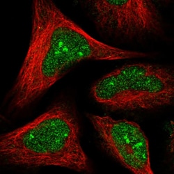 Invitrogen HDDC2 Polyclonal Antibody 100 &mu;L; Unconjugated:Antibodies,