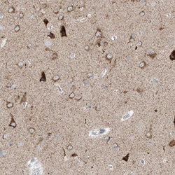 Invitrogen RPP40 Polyclonal Antibody 100 &mu;L; Unconjugated:Antibodies,