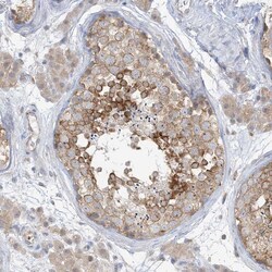 Invitrogen RPP40 Polyclonal Antibody 100 &mu;L; Unconjugated:Antibodies,