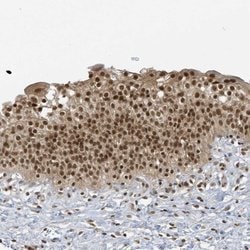 ZNF740 Polyclonal Antibody, Invitrogen 100 &mu;L; Unconjugated:Antibodies,