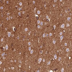 Invitrogen gamma Adducin Polyclonal Antibody 100 &mu;L; Unconjugated:Antibodies,