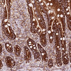 Invitrogen gamma Adducin Polyclonal Antibody 100 &mu;L; Unconjugated:Antibodies,