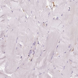 Invitrogen gamma Adducin Polyclonal Antibody 100 &mu;L; Unconjugated:Antibodies,