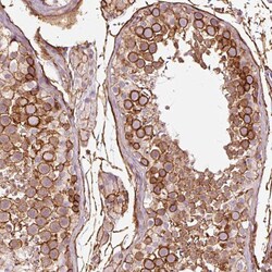 Invitrogen gamma Adducin Polyclonal Antibody 100 &mu;L; Unconjugated:Antibodies,