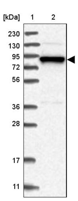 Invitrogen gamma Adducin Polyclonal Antibody 100 &mu;L | Buy Online | Invitrogen&trade; | Fisher Scientific