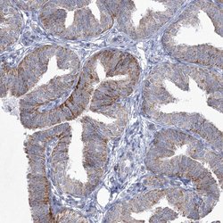 Invitrogen CES4A Polyclonal Antibody 100 &mu;L; Unconjugated:Antibodies,