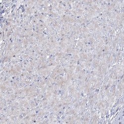 Invitrogen CES4A Polyclonal Antibody 100 &mu;L; Unconjugated:Antibodies,