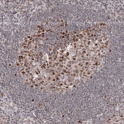 Invitrogen IWS1 Polyclonal Antibody 100 &mu;L; Unconjugated:Antibodies,