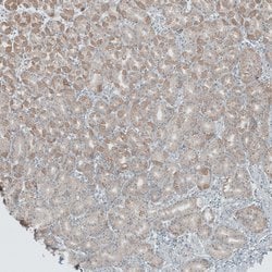 Invitrogen ANO7 Polyclonal Antibody 100 &mu;L; Unconjugated:Antibodies,