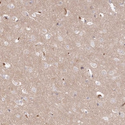 Invitrogen SERC1 Polyclonal Antibody 100 &mu;L; Unconjugated:Antibodies,