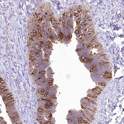 Invitrogen LRRC34 Polyclonal Antibody 100 &mu;L; Unconjugated:Antibodies,