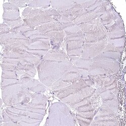 Invitrogen LRRC34 Polyclonal Antibody 100 &mu;L; Unconjugated:Antibodies,