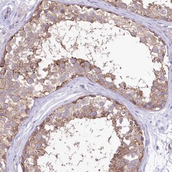 Invitrogen LRRC34 Polyclonal Antibody 100 &mu;L; Unconjugated:Antibodies,