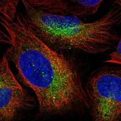 Invitrogen ZBTB45 Polyclonal Antibody 100 &mu;L; Unconjugated:Antibodies,