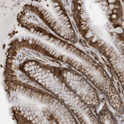 Invitrogen ZBTB45 Polyclonal Antibody 100 &mu;L; Unconjugated:Antibodies,