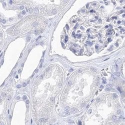 Invitrogen MYOZ2 Polyclonal Antibody 100 &mu;L; Unconjugated:Anticuerpos