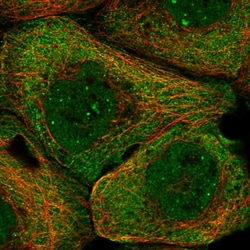 Invitrogen PHF22 Polyclonal Antibody 100 &mu;L; Unconjugated:Anticorps,