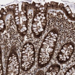 Invitrogen PHF22 Polyclonal Antibody 100 &mu;L; Unconjugated:Anticorps,
