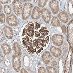 Invitrogen ZNF16 Polyclonal Antibody 100 &mu;L; Unconjugated:Antibodies,
