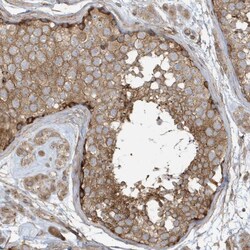 Invitrogen XRCC6BP1 Polyclonal Antibody 100 &mu;L; Unconjugated:Antibodies,