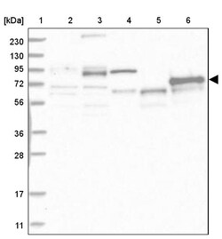 Invitrogen ABLIM2 Polyclonal Antibody 100 &mu;L; Unconjugated:Antibodies,