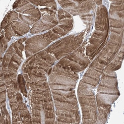 Invitrogen TRIM60 Polyclonal Antibody 100 &mu;L; Unconjugated:Antibodies,
