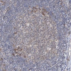 Invitrogen CLEC16A Polyclonal Antibody 100 &mu;L | Buy Online | Invitrogen&trade; | Fisher Scientific