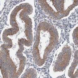 Invitrogen CLEC16A Polyclonal Antibody 100 &mu;L | Buy Online | Invitrogen&trade; | Fisher Scientific