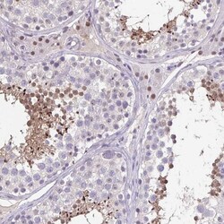 Invitrogen ACTRT3 Polyclonal Antibody 100 &mu;L; Unconjugated:Antibodies,