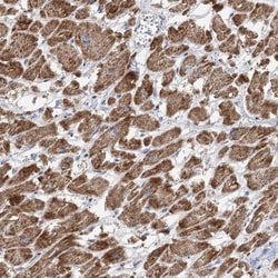 Invitrogen PPP2R3A Polyclonal Antibody 100 &mu;L; Unconjugated:Antibodies,