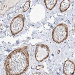 Invitrogen GTF3C2 Polyclonal Antibody 100 &mu;L; Unconjugated:Antibodies,