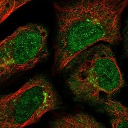 Invitrogen GCC2 Polyclonal Antibody 100 &mu;L | Buy Online | Invitrogen&trade; | Fisher Scientific