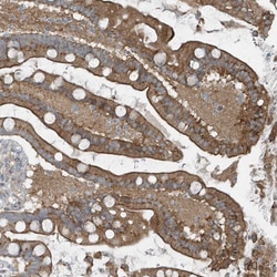Invitrogen GCC2 Polyclonal Antibody 100 &mu;L | Buy Online | Invitrogen&trade; | Fisher Scientific