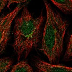 Invitrogen GCC2 Polyclonal Antibody 100 &mu;L; Unconjugated:Antibodies,
