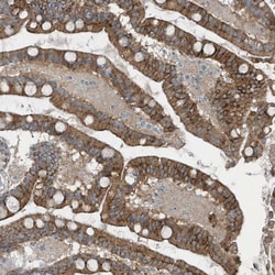 Invitrogen GCC2 Polyclonal Antibody 100 &mu;L; Unconjugated:Antibodies,