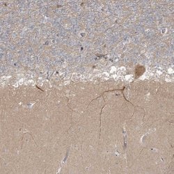 Invitrogen TRIM2 Polyclonal Antibody 100 &mu;L; Unconjugated:Antibodies,