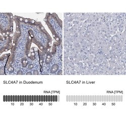 Invitrogen SLC4A7 Polyclonal Antibody 100 &mu;L; Unconjugated:Antibodies,