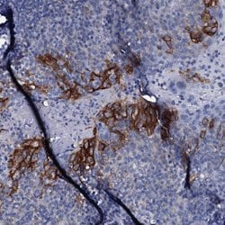 Invitrogen SLC4A7 Polyclonal Antibody 100 &mu;L; Unconjugated:Antibodies,