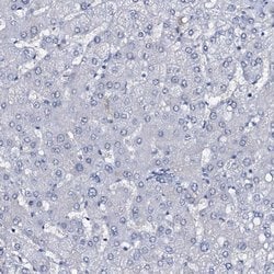Invitrogen SLC4A7 Polyclonal Antibody 100 &mu;L; Unconjugated:Antibodies,