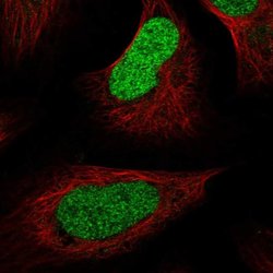 Macro H2A.2, Polyclonal, Invitrogen 100&mu;L; Unconjugated:Antibodies,