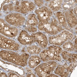 Invitrogen THG1L Polyclonal Antibody 100 &mu;L; Unconjugated:Antibodies,