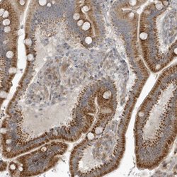 Invitrogen THG1L Polyclonal Antibody 100 &mu;L; Unconjugated:Antibodies,