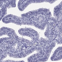 Invitrogen LYAR Polyclonal Antibody 100 &mu;L; Unconjugated:Antibodies,