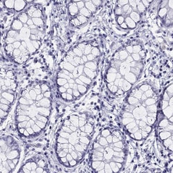 Invitrogen LYAR Polyclonal Antibody 100 &mu;L; Unconjugated:Antibodies,