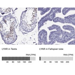 Invitrogen LYAR Polyclonal Antibody 100 &mu;L; Unconjugated:Antibodies,