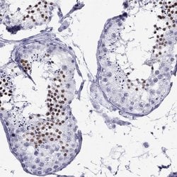 Invitrogen LYAR Polyclonal Antibody 100 &mu;L; Unconjugated:Antibodies,