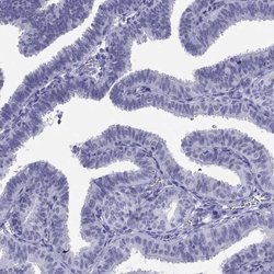 Invitrogen LYAR Polyclonal Antibody 100 &mu;L; Unconjugated:Antibodies,
